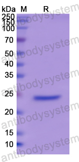 Recombinant Human GH2 Protein, N-His