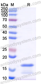 Recombinant Human PCT/Procalcitonin Protein, N-His