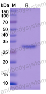 Recombinant Human TG Protein, N-His