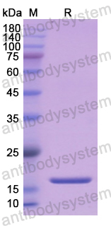 Recombinant Human VIP Protein, N-His