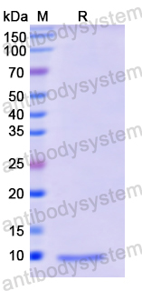 Recombinant Human IGF2 Protein, N-His