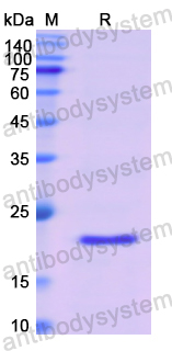 Recombinant Human LTA Protein, N-His