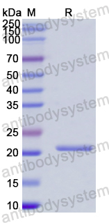 Recombinant Human IFNA2/IFN-alpha-2 Protein, N-His