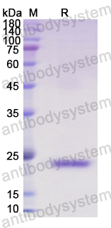 Recombinant Human IFNB1/IFN-beta Protein, N-His