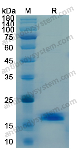 Recombinant Human IFNG/IFN-gamma Protein, N-His