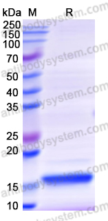 Recombinant Human IFNG/IFN-gamma Protein, N-His