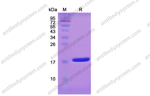 Recombinant Human IL1B/IL1F2 Protein, C-His