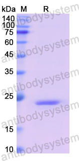 Recombinant Human EPO Protein, N-His