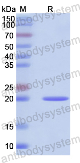 Recombinant Human EPO Protein, N-His