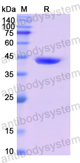 Recombinant Human CD4 Protein, N-His