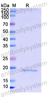 Recombinant Human CD8A Protein, N-His