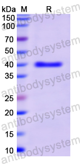 Recombinant Human PIGR Protein, N-His