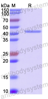 Recombinant Human AD7c-NTP Protein, N-His