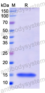 Recombinant Human COL1A1 Protein, N-His