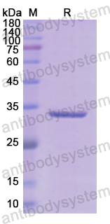 Recombinant Human COL1A1 Protein, N-His