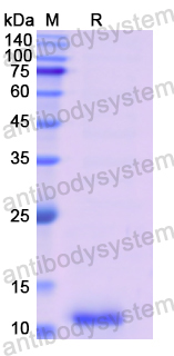 Recombinant Human COL2A1 Protein, N-His