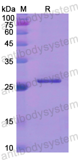 Recombinant Human COL4A1 Protein, N-His