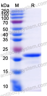 Recombinant Human CRYAB Protein, N-His