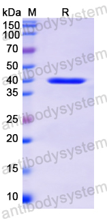 Recombinant Human KRT14 Protein, N-His