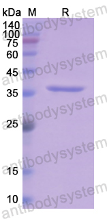 Recombinant Human APOE Protein, N-His