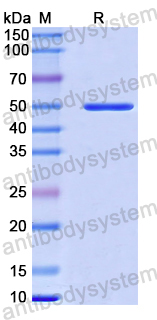 Recombinant Human APOE Protein, N-GST & C-His
