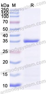 Recombinant Human FGA Protein, N-His