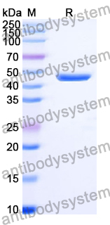 Recombinant Human FGB/Fibrinogen beta Protein, N-His