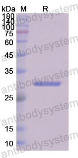 Recombinant Human FGG Protein, N-His