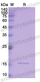 Recombinant Human CD235a/GYPA Protein, N-His