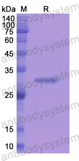 Recombinant Human CD233/SLC4A1 Protein, N-His