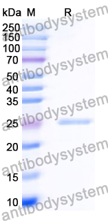 Recombinant Human CD233/SLC4A1 Protein, C-His