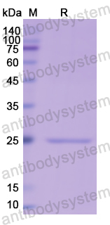 Recombinant Human CRP Protein, N-His