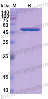 Recombinant Human APCS Protein, N-GST