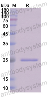 Recombinant Human C1QA Protein, N-His