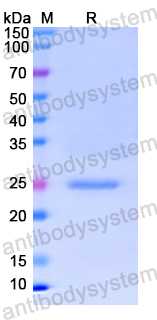 Recombinant Human C1QB Protein, N-His