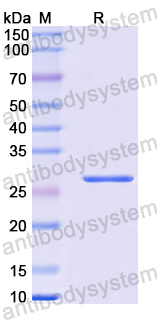 Recombinant Human C1QB Protein, N-His-SUMO