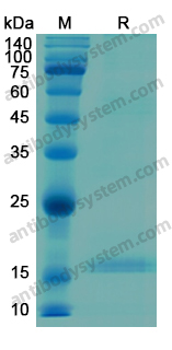 Recombinant Human C1QC Protein, N-His