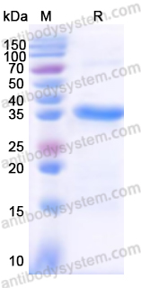 Recombinant Human C9 Protein, N-His