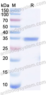 Recombinant Human LRG1 Protein, N-His