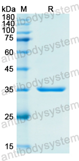 Recombinant Human FN1 Protein, N-His