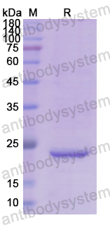 Recombinant Human RBP4 Protein, N-His