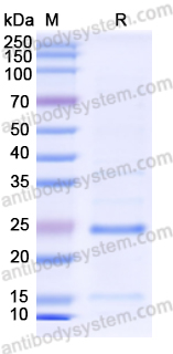 Recombinant Human ORM1/a1AGP Protein, N-His