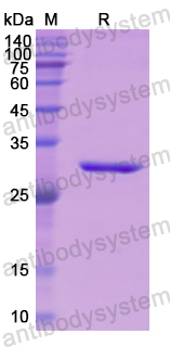 Recombinant Human AHSG Protein, N-His