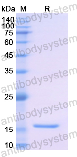 Recombinant Human TTR Protein, N-His