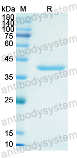 Recombinant Human AFP Protein, N-His