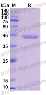 Recombinant Human DBP/GC Protein, N-His