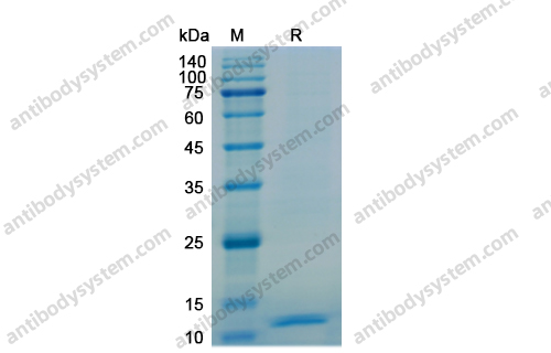 Recombinant Human CXCL10/IP-10 Protein, N-His