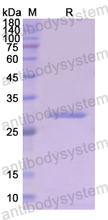 Recombinant Human CD71/TFRC Protein, N-His