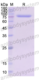 Recombinant Human LTF Protein, N-His