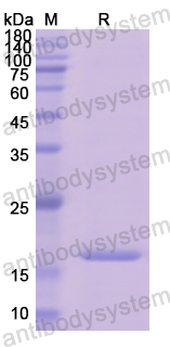 Recombinant Human HPX Protein, N-His